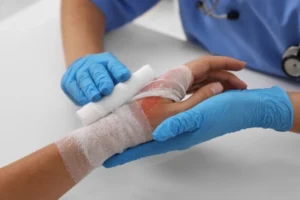 burn injury in Atlanta